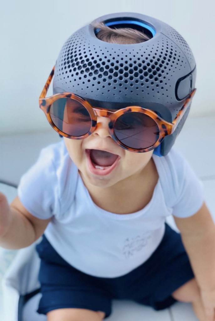 Kid with a cranial helmet on