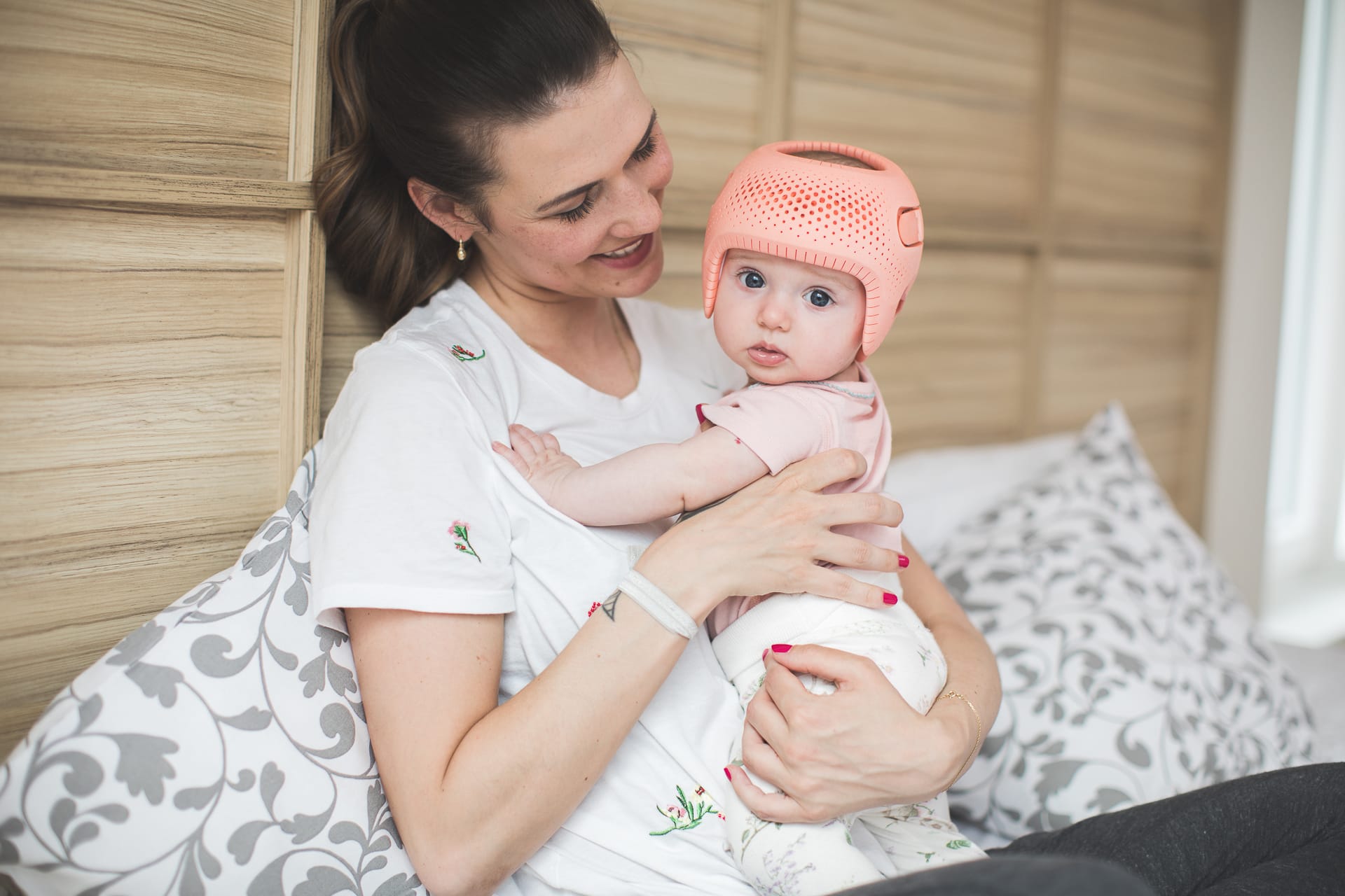 Woman holding a baby with a cranial helmet